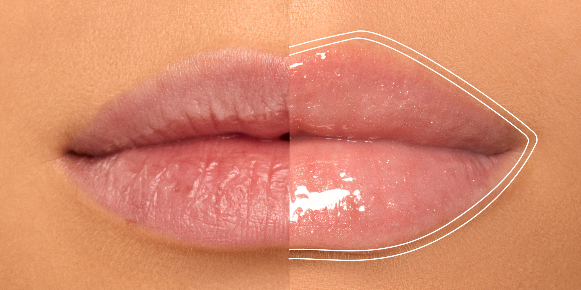 BUXOM Lip Plumper Safety: Tingling, Dryness, Long-Term Effects